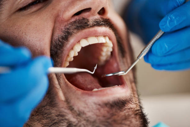 Best Emergency Dental Surgery in Burlington, VT