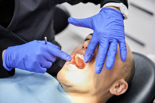 Best Emergency Root Canal Treatment in Burlington, VT