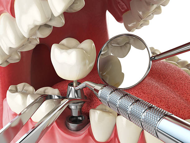 Trusted VT Emergency Dentist Experts