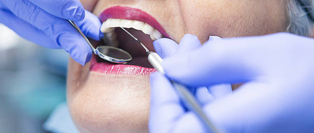 Best Emergency Treatment for Toothache in Burlington, VT
